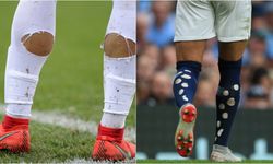 Dünya Kupası'nda da sıkça gördük: Futbolcular çoraplarını neden keser? Çoraplarındaki delikler ne işe yarıyor?