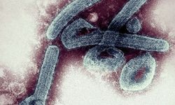 Tanzanya'da 5 kişinin ölümüne sebep oldu: Marburg virüsü!