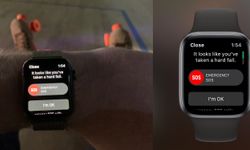 Kullanıcıların başı Apple Watch ile dertte! İşte nedeni...