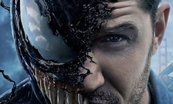 Tom Hardy, Venom filminin ardından iki kez dizlerinden ameliyat geçirdiğini açıkladı