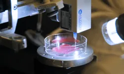 Dünyanın ilk 3D biyo-yazıcıyla gerçekleştirilen kulak nakli!