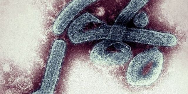 Tanzanya'da 5 kişinin ölümüne sebep oldu: Marburg virüsü!