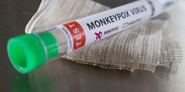 Dünya Sağlık Örgütü'nden 'maymun çiçeği virüsü' açıklaması