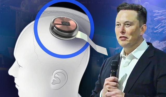 Elon Musk tarih verdi: Neuralink beyin çipi için insan testleri başlıyor