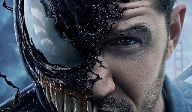 Tom Hardy, Venom filminin ardından iki kez dizlerinden ameliyat geçirdiğini açıkladı