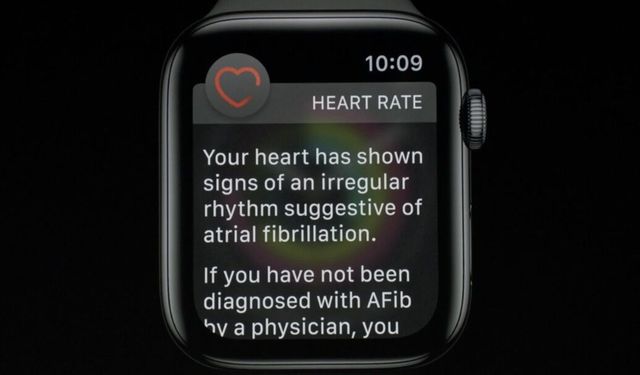 Doktor Watch diyeceksiniz! Apple Watch, bir hayat daha kurtardı