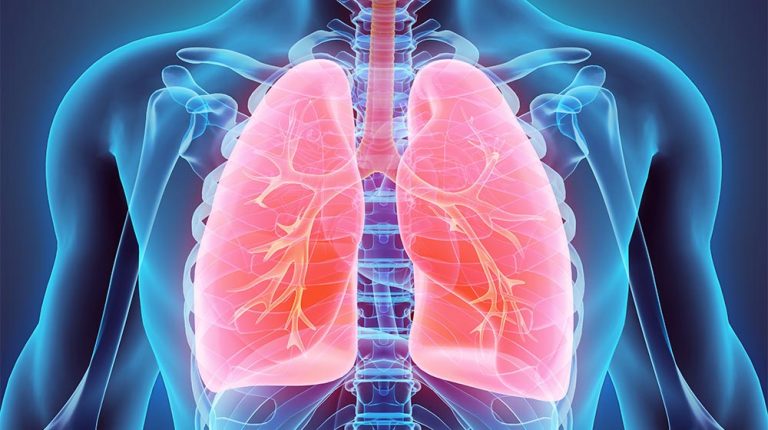 3D-illustration-of-Lungs-Chronic-Lower-Respiratory-Disease-ss-feat-768x430-1