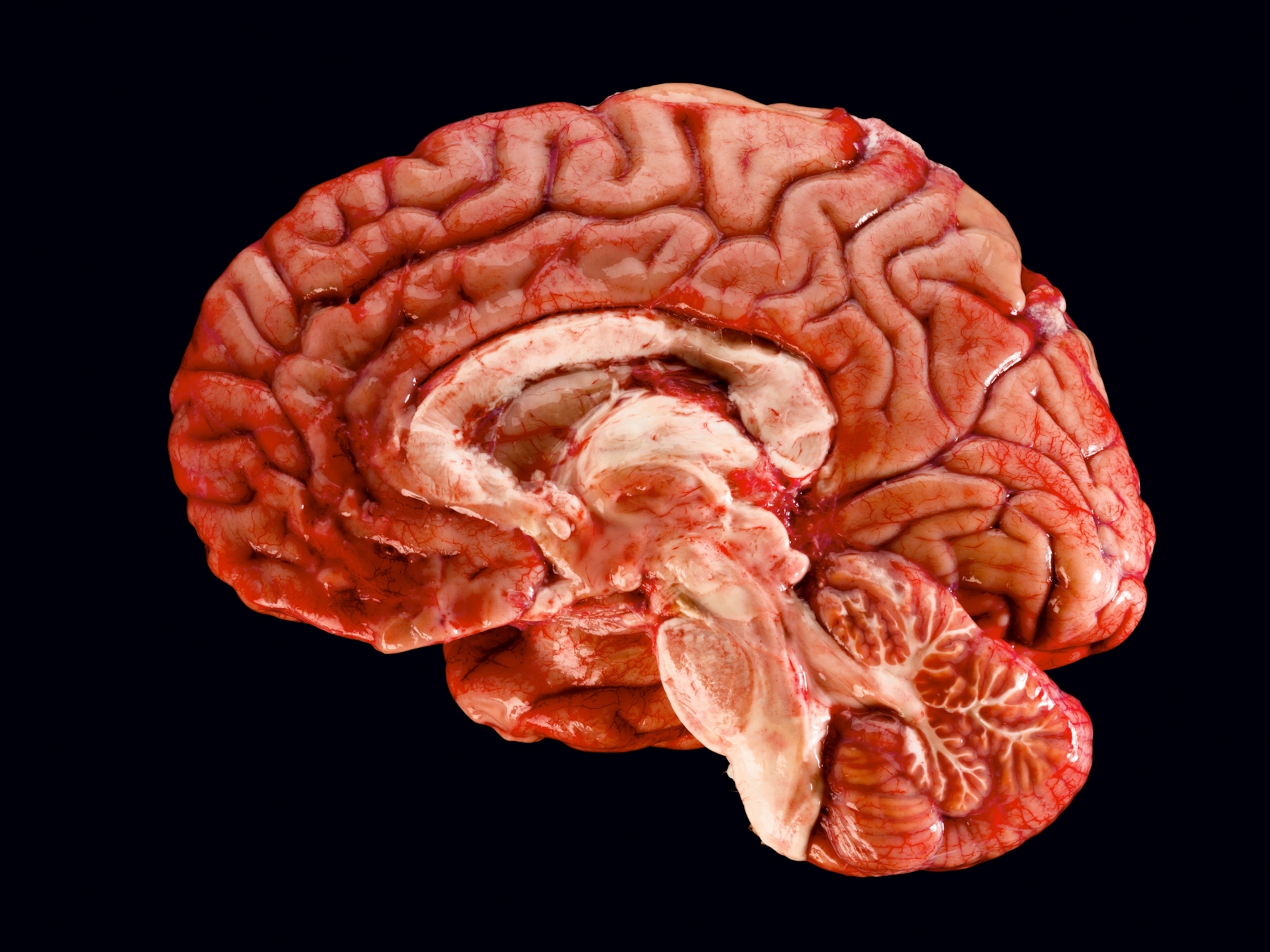 Brain фото. Настоящий человеческий мозг.