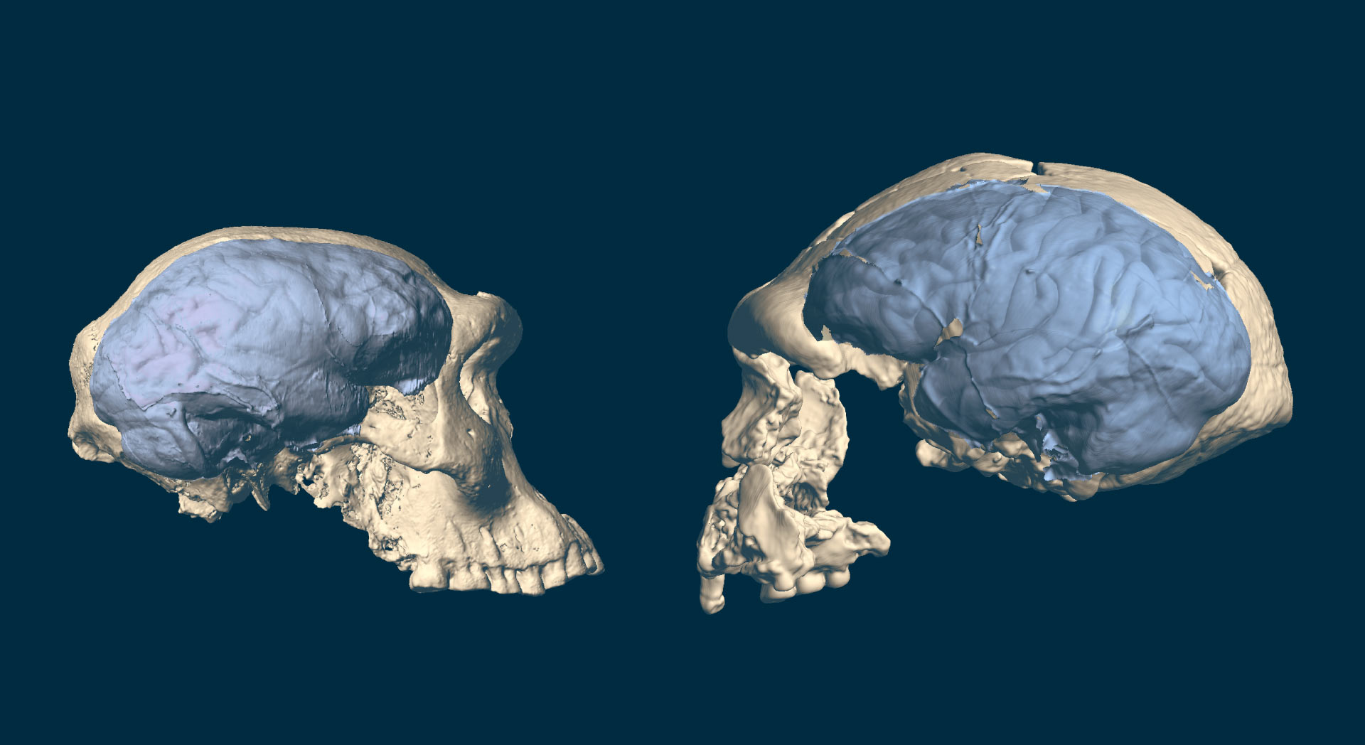 insan beyni (3)
